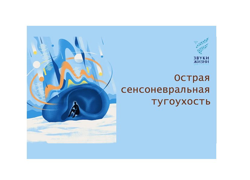 Острая  сенсоневральная тугоухость